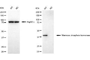 Western blotting analysis using mannose phosphate isomerase antibody (ABIN7799328). (MPI 抗体)