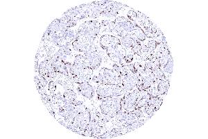 Mature placenta showing a strong Cyclin E1 staining of most cytotrophoblast cells (Recombinant Cyclin E1 抗体)