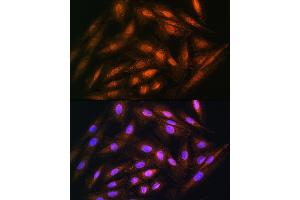 Immunofluorescence analysis of H9C2 cells using DUSP14 Rabbit pAb (ABIN6127789, ABIN6139865, ABIN6139866 and ABIN6214482) at dilution of 1:100. (DUSP14 抗体  (AA 1-198))
