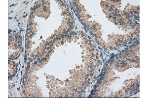 Immunohistochemical staining of paraffin-embedded colon tissue using anti-PDE4A mouse monoclonal antibody. (PDE4A 抗体)