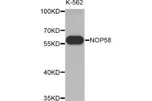 Western blot analysis of extracts of K-562 cell line, using NOP58 antibody. (NOP58 抗体  (AA 360-529))