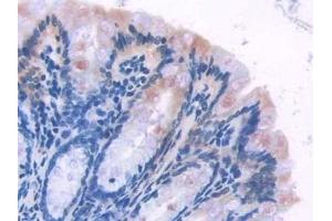 Immunohistochemistry (IHC) image for anti-Chromosome 6 Open Reading Frame 150 (C6orf150) (AA 211-395) antibody (ABIN7443491)