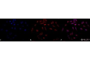 Immunocytochemistry/Immunofluorescence analysis using Mouse Anti-Hsp47 Monoclonal Antibody, Clone 1C4-1A6 . (SERPINH1 抗体)