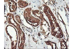 Immunohistochemical staining of paraffin-embedded Human Kidney tissue using anti-KCNAB1 mouse monoclonal antibody. (KCNAB1 抗体)