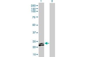 Western Blot analysis of FGF23 expression in transfected 293T cell line by FGF23 MaxPab polyclonal antibody. (FGF23 抗体  (AA 1-251))