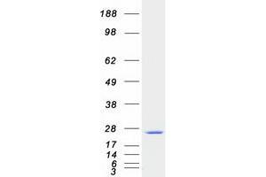 SAR1 Homolog A (SAR1A) (Transcript Variant 2) protein (Myc-DYKDDDDK Tag)