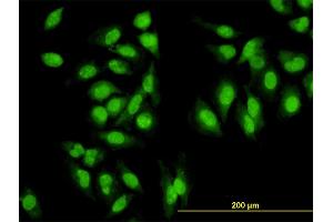 Immunofluorescence of monoclonal antibody to SYMPK on HeLa cell. (Symplekin 抗体  (AA 1-533))