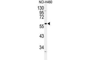 Western blot analysis of ADRA1B Antibody (Center) in NCI-H460 cell line lysates (35µg/lane). (ADRA1B 抗体  (Middle Region))