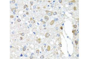 Immunohistochemistry of paraffin-embedded Rat brain using BAG5 Polyclonal Antibody at dilution of 1:100 (40x lens). (BAG5 抗体)