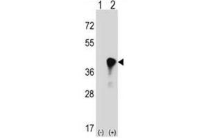 Western blot analysis of C4BPB (arrow) using rabbit polyclonal C4BPB Antibody (Center) . (C4BPB 抗体  (Middle Region))