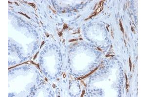 Formalin-fixed, paraffin-embedded human prostate stained with CD31 Mouse Monoclonal Antibody (PECAM1/3527).