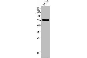 Western Blot analysis of SKOV3 cells using CD292 Polyclonal Antibody (BMPR1A 抗体  (N-Term))