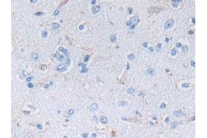 Detection of NES in Human Cerebrum Tissue using Polyclonal Antibody to Nestin (NES) (Nestin 抗体  (AA 178-399))
