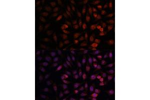 Immunofluorescence analysis of L929 cells using DDX24 antibody (ABIN7266691) at dilution of 1:100. (DDX24 抗体  (AA 510-859))