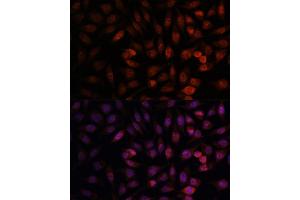 Immunofluorescence analysis of L929 cells using DDX24 antibody (ABIN7266691) at dilution of 1:100. (DDX24 抗体  (AA 510-859))