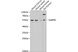 Western blot analysis of extracts of various cell lines, using G antibody (ABIN6130410, ABIN6140895, ABIN6140896 and ABIN6220279) at 1:1000 dilution. (GABPB2 抗体  (AA 239-448))