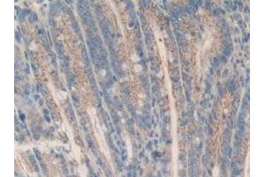 Immunohistochemistry (IHC) image for anti-Induced Myeloid Leukemia Cell Differentiation Protein Mcl-1 (MCL1) (AA 2-307) antibody (ABIN7440890)