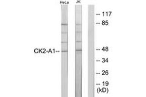 Western blot analysis of extracts from HeLa/Jurkat cells, using Casein Kinase II alpha (Ab-255) Antibody. (CSNK2A1/CK II alpha 抗体  (AA 221-270))