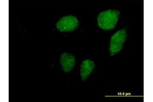 Immunofluorescence of purified MaxPab antibody to VCX3A on HeLa cell. (VCX3A 抗体  (AA 1-166))