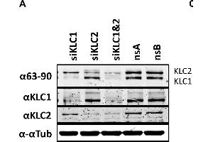 The effect of KLC knock-down by siRNA on virus egress. (KLC1 抗体)