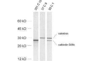 dilution: 1 : 1000, sample: rat brain homogenate (Calbindin D28k/D29k 抗体)