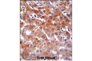Immunohistochemistry (Paraffin-embedded Sections) (IHC (p)) image for anti-Cytochrome P450, Family 1, Subfamily A, Polypeptide 2 (CYP1A2) (AA 255-282) antibody (ABIN655272)