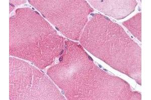 Immunohistochemistry of ARC in human heart tissue (A) and skeletal muscle (B) with ARC antibody at 5 μg/ml. (NOL3 抗体  (C-Term))