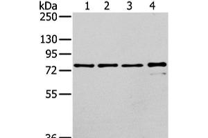 Western Blot analysis of Raji, K562, skov3 and pc3 cell using GHR Polyclonal Antibody at dilution of 1/400 (Growth Hormone Receptor 抗体)
