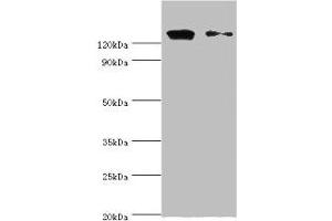 Western blot All lanes: CCAR1 antibody at 10 μg/mL Lane 1: Hela whole cell lysate Lane 2: PC-3 whole cell lysate Secondary Goat polyclonal to rabbit IgG at 1/10000 dilution Predicted band size: 133, 132 kDa Observed band size: 133 kDa (CCAR1 抗体  (AA 1-200))