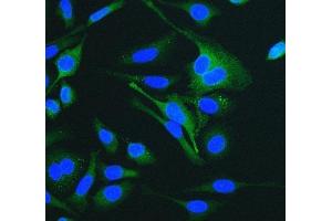 IF analysis of Cytokeratin 18 using anti-Cytokeratin 18 antibody (ABIN7600573).