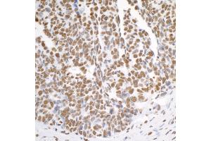 Immunohistochemistry (IHC) image for anti-Heterogeneous Nuclear Ribonucleoprotein K (HNRNPK) (C-Term) antibody (ABIN7454660) (HNRNPK 抗体  (C-Term))