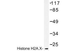 Image no. 1 for anti-H2A Histone Family, Member X (H2AFX) antibody (ABIN317781) (H2AFX 抗体)