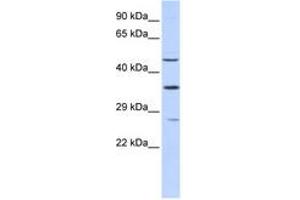 Image no. 1 for anti-Myocyte Enhancer Factor 2B (MEF2B) (N-Term) antibody (ABIN6742793) (MEF2B 抗体  (N-Term))