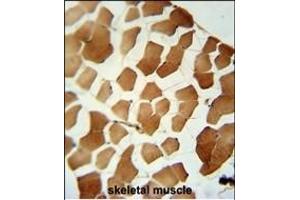 P6C Antibody (C-term) (ABIN6242920 and ABIN6579047) immunohistochemistry analysis in formalin fixed and paraffin embedded human skeletal muscle followed by peroxidase conjugation of the secondary antibody and DAB staining. (PPP6C 抗体  (C-Term))