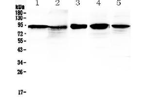 Western blot analysis of beta Catenin using anti-beta Catenin antibody . (CTNNB1 抗体  (AA 2-233))