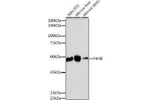 Western blot analysis of extracts of various cell lines, using P4HB antibody (ABIN7269560) at 1:1000 dilution. (P4HB 抗体)