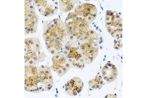 Immunohistochemistry (Paraffin-embedded Sections) (IHC (p)) image for anti-RAD23 Homolog B (RAD23B) (AA 50-150) antibody (ABIN6146632)