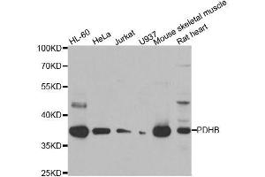 Western blot analysis of extracts of various cell lines, using PDHB antibody. (PDHB 抗体  (AA 1-300))