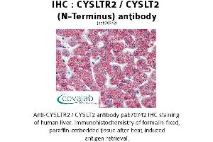 Image no. 1 for anti-Cysteinyl Leukotriene Receptor 2 (CYSLTR2) (N-Term) antibody (ABIN1733466) (CasLTR2 抗体  (N-Term))