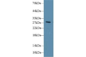 Western Blot; Sample: Rat Blood Cells lysate; Primary Ab: 1µg/ml Rabbit Anti-Rat DIO3 Antibody Second Ab: 0. (DIO3 抗体  (AA 37-169))