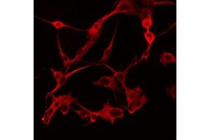 ABIN6274791 staining COLO205 by IF/ICC. (ABHD6 抗体  (Internal Region))