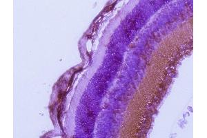 Immunohistochemistry (IHC) image for anti-RAB27A, Member RAS Oncogene Family (RAB27A) (C-Term) antibody (ABIN1440000) (RAB27A 抗体  (C-Term))