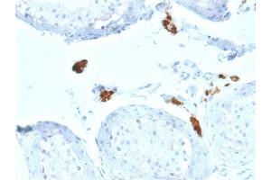 Immunohistochemistry (IHC) image for anti-Calbindin 2 (CALB2) (AA 23-242) antibody (ABIN6940931)