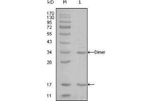 Western Blot showing EP300 antibody used against truncated EP300-His recombinant protein (1). (p300 抗体)