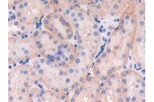 Immunohistochemistry (IHC) image for anti-Chromosome 6 Open Reading Frame 150 (C6orf150) (AA 211-395) antibody (ABIN7443491)