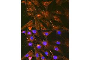 Immunofluorescence (IF) image for anti-Cortactin (CTTN) antibody (ABIN7266511)