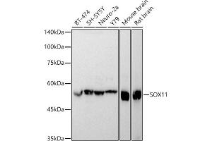 Western blot analysis of extracts of various cell lines, using SOX11 antibody (ABIN7270569) at 1:1000 dilution. (SOX11 抗体)