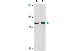 Western blot analysis of LRFN3 in K-562 cell lysate with LRFN3 polyclonal antibody  at (A) 1 and (B) 2 ug/mL . (LRFN3 抗体  (Internal Region))