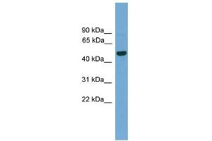 WB Suggested Anti-GRAMD3 Antibody Titration:  0. (GRAMD3 抗体  (Middle Region))