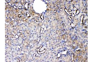 Immunohistochemistry (IHC) image for anti-serpin Peptidase Inhibitor, Clade A (Alpha-1 Antiproteinase, Antitrypsin), Member 5 (SERPINA5) (AA 86-406) antibody (ABIN5518789)